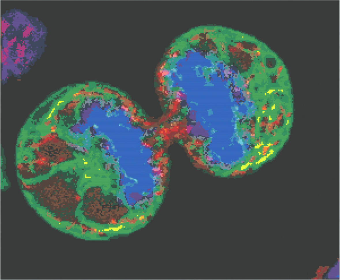 Portrait: Melanoma Cell Division (Original image credit: Human melanoma cell dividing. Paul J.Smith &amp;Rachel Errington. Source: Wellcome Collection.)